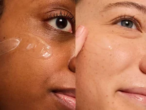 Skin hydration