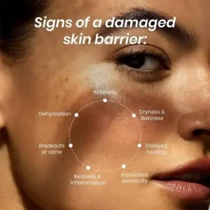 skin barrier